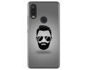 Funda Gel Tpu para VSmart Active 1 diseño Barba Dibujos