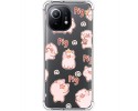Funda Silicona Antigolpes para Xiaomi Mi 11 5G diseño Cerdos Dibujos