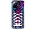 Funda Silicona Antigolpes para Xiaomi Mi 11 5G diseño Zapatillas 07 Dibujos