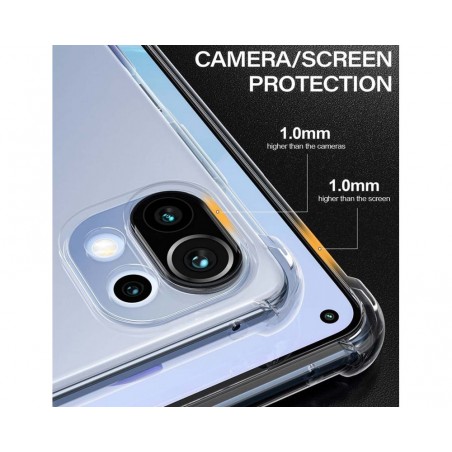 Funda Gel Tpu Anti-Shock Transparente para Xiaomi Mi 11 Lite 4G / 5G / 5G NE