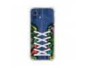 Funda Silicona Antigolpes para Xiaomi Mi 11 Lite 4G / 5G / 5G NE diseño Zapatillas 13 Dibujos