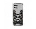 Funda Silicona Antigolpes para Xiaomi Mi 11 Lite 4G / 5G / 5G NE diseño Zapatillas 16 Dibujos