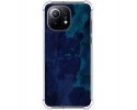 Funda Antigolpes para Xiaomi Mi 11 5G diseño Acuarela 13 Dibujos