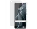Protector Pantalla Hidrogel Flexible para Xiaomi Mi 11 Lite 4G / 5G / 5G NE