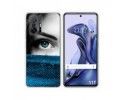 Funda Silicona para Xiaomi 11T 5G / 11T Pro 5G diseño Ojo Dibujos