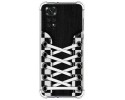 Funda Silicona Antigolpes para Xiaomi Redmi Note 11 / 11s diseño Zapatillas 03 Dibujos