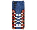 Funda Silicona Antigolpes para Xiaomi Redmi Note 11 / 11s diseño Zapatillas 11 Dibujos