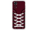 Funda Silicona Antigolpes para Xiaomi Redmi Note 11 / 11s diseño Zapatillas 17 Dibujos