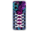 Funda Silicona Antigolpes para Xiaomi Redmi 10 5G diseño Zapatillas 07 Dibujos