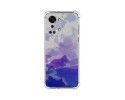 Funda Silicona Antigolpes para OnePlus Nord 2T 5G diseño Acuarela 09 Dibujos