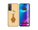 Funda Silicona para TCL 30 / 30 5G / 30 Plus diseño Jirafa Dibujos