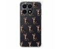 Funda Silicona Antigolpes para Huawei Honor X7a diseño Perros 11 Dibujos