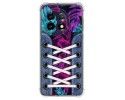 Funda Silicona Antigolpes para Oneplus 11 5G diseño Zapatillas 07 Dibujos
