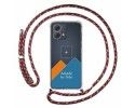 Personaliza tu Funda Colgante Transparente para Motorola Moto G84 5G con Cordon Rosa / Dorado Dibujo Personalizada