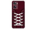 Funda Silicona Antigolpes para Oneplus Nord N20 SE diseño Zapatillas 17 Dibujos