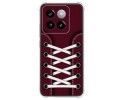 Funda Silicona Antigolpes para Xiaomi 14 5G diseño Zapatillas 17 Dibujos