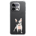 Funda Silicona Antigolpes para Realme 16 Pro+ Plus 5G diseño Perros 06 Dibujos